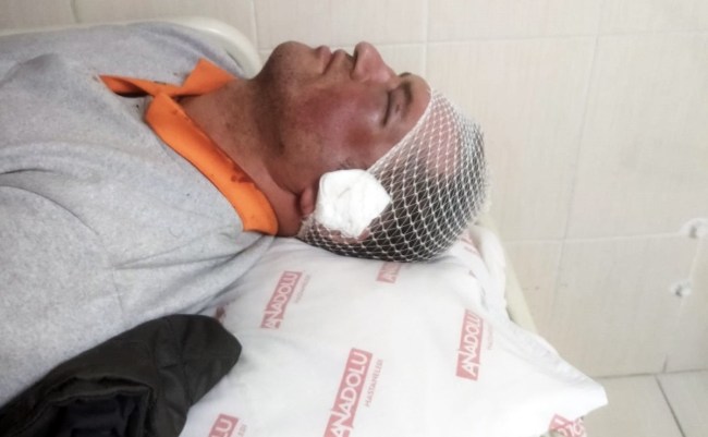 Görevi başındaki temizlik işçisi saldırıya uğradı