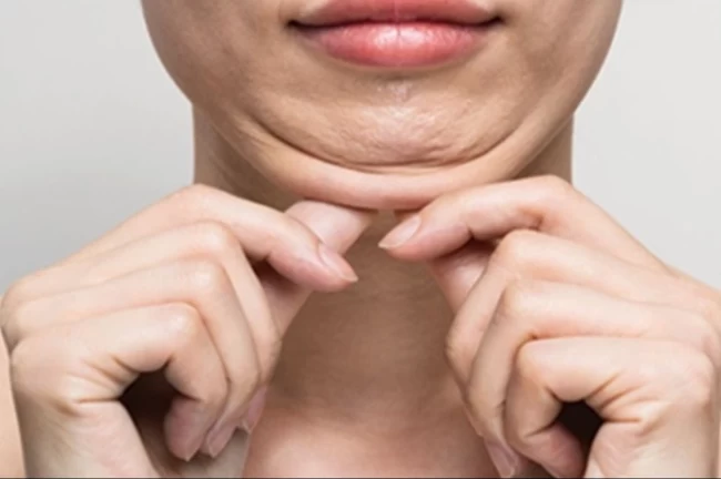 Keşanlı 3 dermatolog, Tiflis'teki Dermavizyon toplantısında buluştu