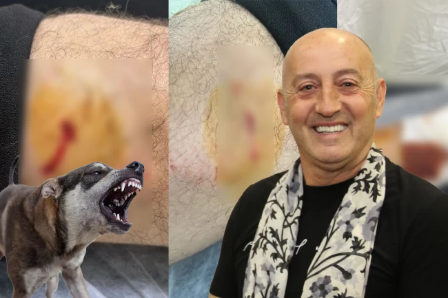 Gemlik Karacaali Muhtarı'na sokak köpeklerinden saldırı!