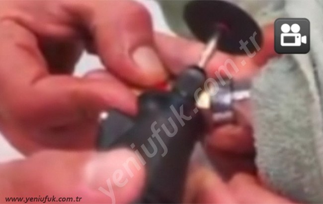 AMELİYAT OLMAKTAN, İTFAİYE KURTARDI!...