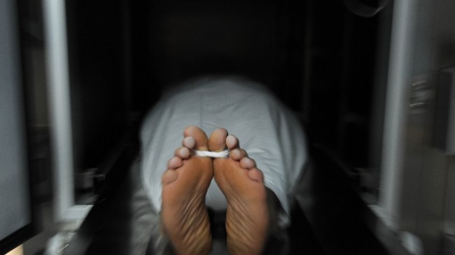 Zonguldaklıları dolaşım sistemi bozukluğu öldürüyor..