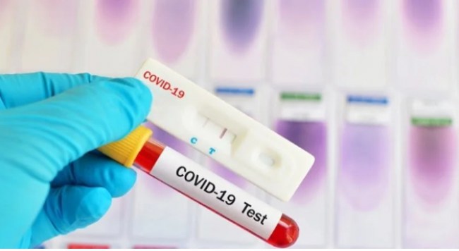 Artık teste değil, belirtilere bakılacak