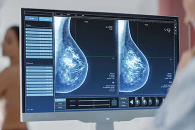 "Mamografi erken tanı ve tedavi için önemli"