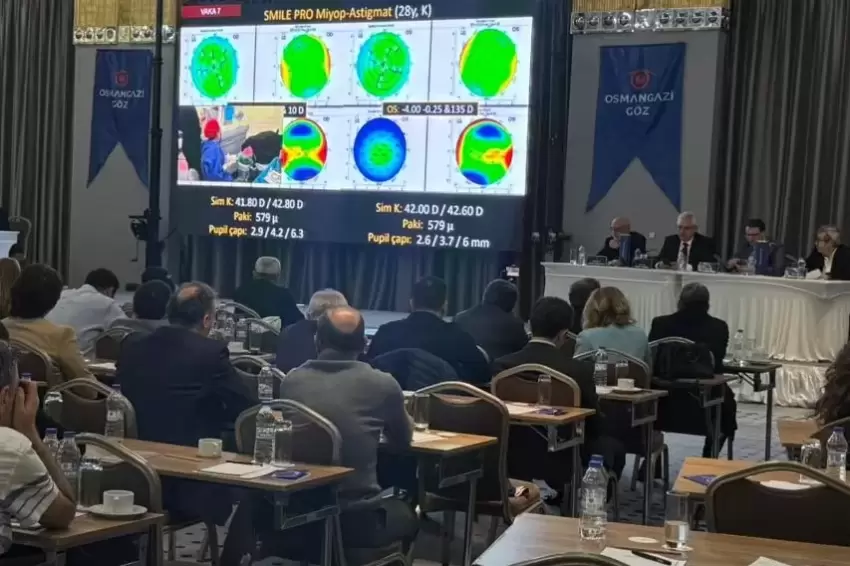Bursada 50 profesörden canlı göz ameliyatı şovu