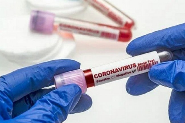 Koronavirüs'e 212 kurban daha