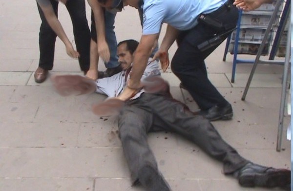 İcralık Olan Engelli, Adliye Çıkışında Kollarını Kesti