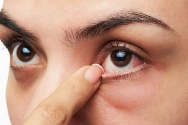 Göz içi basıncı kör edebiliyor