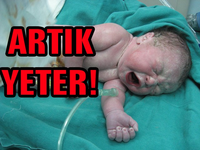 Biri bu rezalate 'dur' desin!..