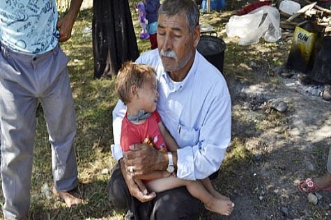 Alaplı'da su deposu patladı: 5 çocuk yaralı