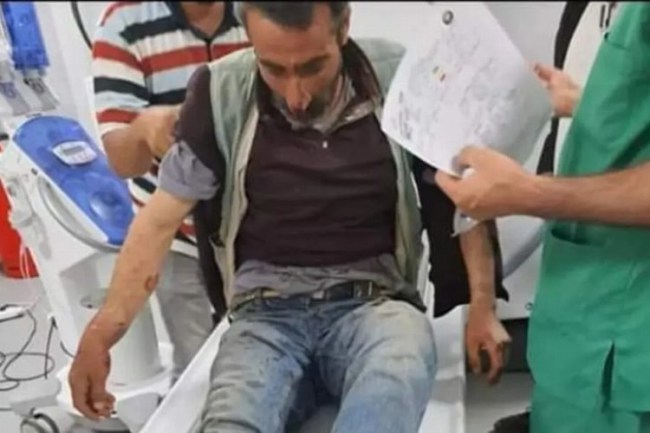 Bingöl'de ayı saldırısına uğrayan vatandaşı köpekler kurtardı