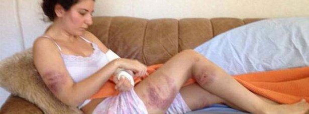 Twıtter'dan dayak fotoğraflarını paylaştı!