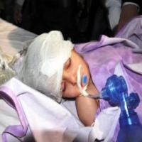 2 Yaşındaki Elif'in başına gaz bombası